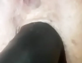 Dilatación anal de Marcela Boccarelli